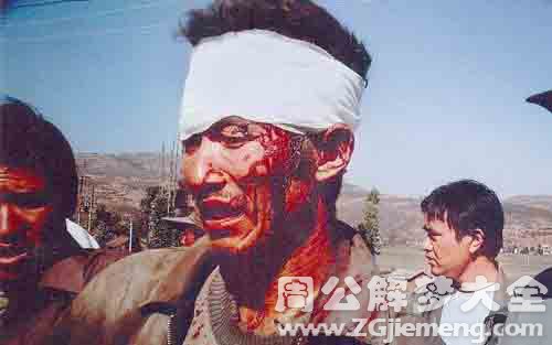 梦见头流血.jpg 梦见头流血.jpg