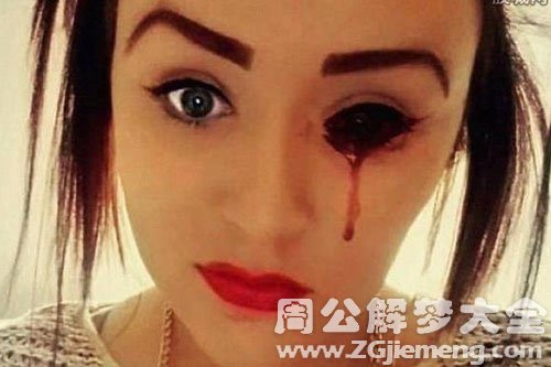 流血-出血 流血-出血