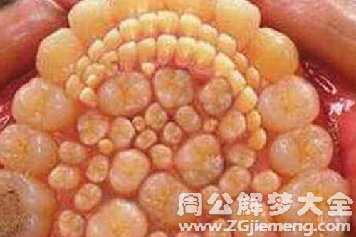 梦见满嘴都是牙 梦见满嘴都是牙