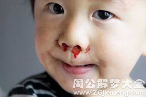 梦见黑色的血 梦见黑色的血