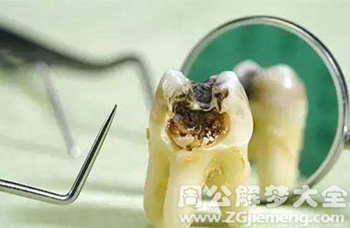 梦见虫子牙掉了 梦见虫子牙掉了