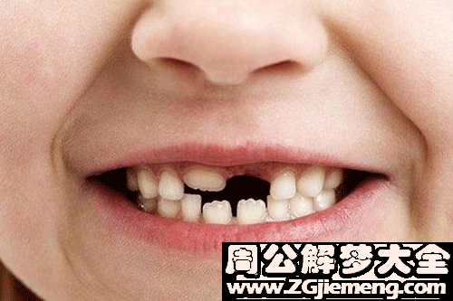 梦见满嘴牙掉了 梦见满嘴牙掉了
