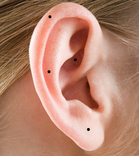 耳朵有痣代表什么