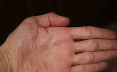 手相怎么看财运,财运不会太差的六种手相 手相怎么看财运,财运不会太差的六种手相