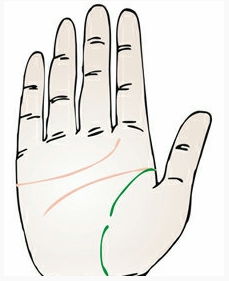 明显中断的生命线代表了什么?