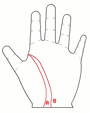 手相图解:你会嫁入豪门做少奶奶吗?