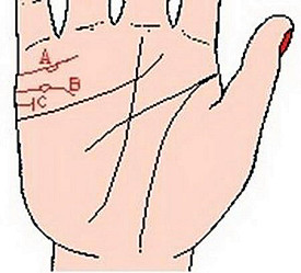 婚姻线上有岛纹表示什么? 婚姻线上有岛纹表示什么?
