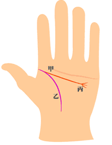 智慧线(甲)与生命线(乙)起点相交，智慧线的尾端到无名指与小指下方，分成三叉(丙)