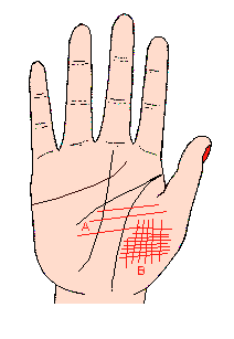 手相 烦恼线【图解】 手相 烦恼线【图解】