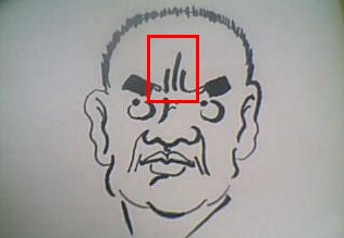 额头有皱纹,脑门皱纹 额头有皱纹,脑门皱纹