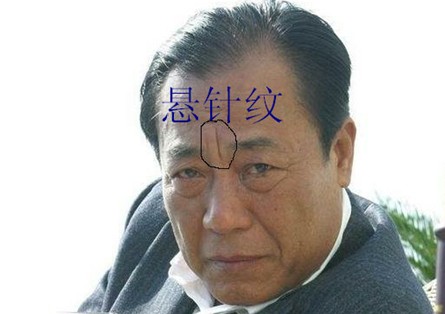 额头有皱纹,脑门皱纹 额头有皱纹,脑门皱纹