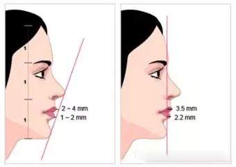 下巴短小的人面相 下巴短小的人面相