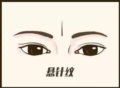 悬针纹怎么去除?悬针纹去除方法盘点 悬针纹怎么去除?悬针纹去除方法盘点