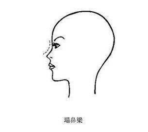 塌鼻子适合什么眼镜,塌鼻子适合什么墨镜 塌鼻子适合什么眼镜,塌鼻子适合什么墨镜