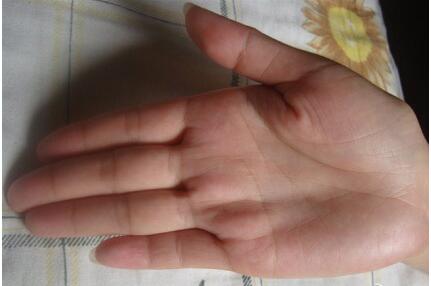 双下巴、掉眉毛、三种手相的解析 双下巴、掉眉毛、三种手相的解析