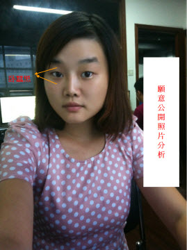 A 字肩,睡姿,肥胖,男人肩膀肉多的分析 A 字肩,睡姿,肥胖,男人肩膀肉多的分析