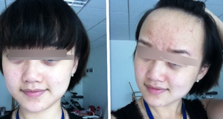 满额疮痍,有额纹,额多杂毛,眉乱的照片分析 满额疮痍,有额纹,额多杂毛,眉乱的照片分析