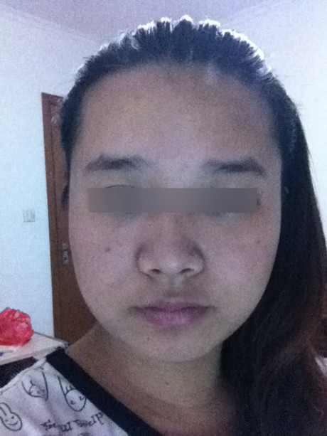 满额疮痍,有额纹,额多杂毛,眉乱的照片分析 满额疮痍,有额纹,额多杂毛,眉乱的照片分析