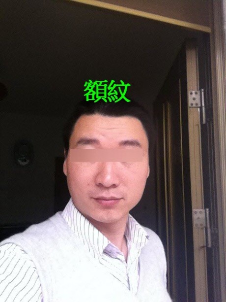 满额疮痍,有额纹,额多杂毛,眉乱的照片分析 满额疮痍,有额纹,额多杂毛,眉乱的照片分析