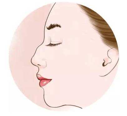 凹陷鼻有哪些说法? 凹陷鼻有哪些说法?