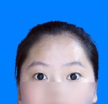 目露凶光,额头扁平,五官不清晰的照片分析 目露凶光,额头扁平,五官不清晰的照片分析