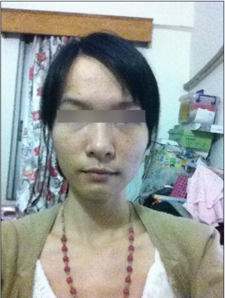 目露凶光,额头扁平,五官不清晰的照片分析 目露凶光,额头扁平,五官不清晰的照片分析