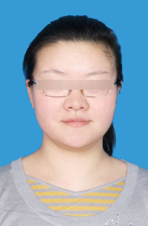 目露凶光,额头扁平,五官不清晰的照片分析 目露凶光,额头扁平,五官不清晰的照片分析