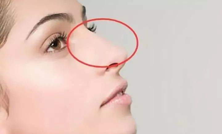 女人的鼻子与婚姻 女人的鼻子与婚姻