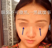 卧蚕颜色,三亭平均,发际线高,额不饱满的详解