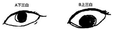三白眼人的外貌与人品! 三白眼人的外貌与人品!