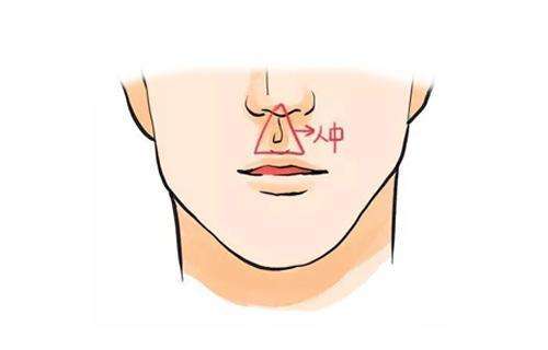 人中无沟好不好? 人中无沟好不好?