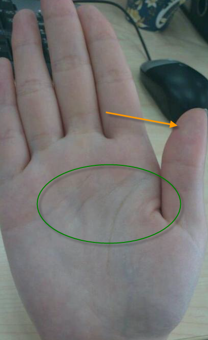 男生断掌,两条头脑线,天狗线,金星线的详解 男生断掌,两条头脑线,天狗线,金星线的详解