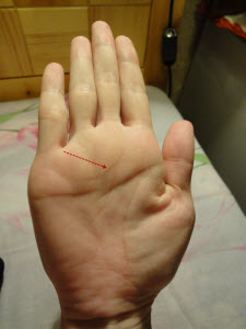 男生断掌,两条头脑线,天狗线,金星线的详解 男生断掌,两条头脑线,天狗线,金星线的详解