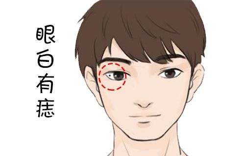 不育妇女掌相、眼白有痣、掌色鲜红的详解 不育妇女掌相、眼白有痣、掌色鲜红的详解