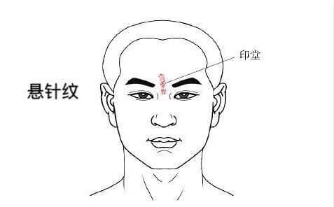 女人悬针纹面相好不好 印堂面相解析 女人悬针纹面相好不好 印堂面相解析
