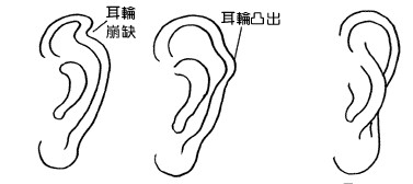 耳朵面相算命图解 耳朵面相算命图解