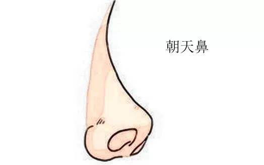 朝天鼻什么意思_朝天鼻面相好吗? 朝天鼻什么意思_朝天鼻面相好吗?