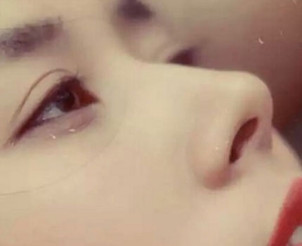 金鱼眼面相好不好? 金鱼眼面相好不好?