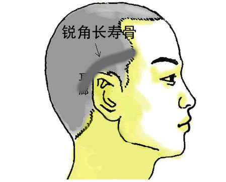锐角长寿骨 锐角长寿骨