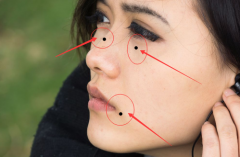 脸上黑痣图解女，女人脸上长黑痣好不好